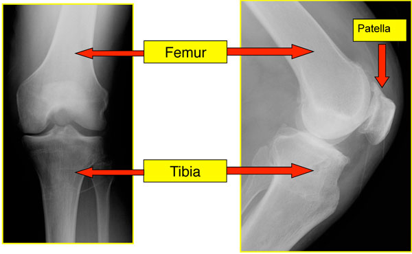 Basic Knee Anatomy